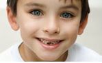 Сколотые зубы у ребенка